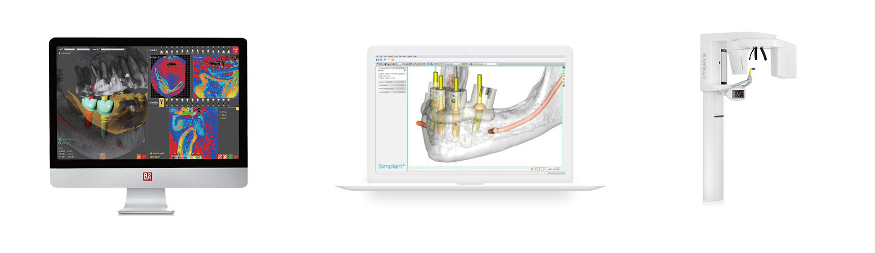 Intraoralscanner